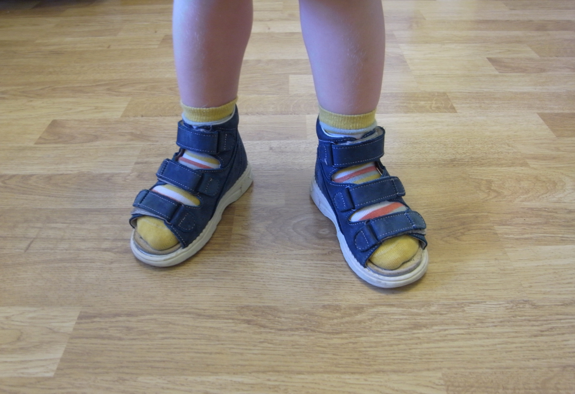 Ортопедическая детская обувь