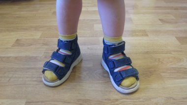 Ортопедическая детская обувь